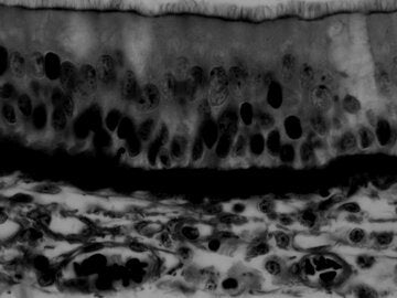 Trachea epithelium. Light micrograph 