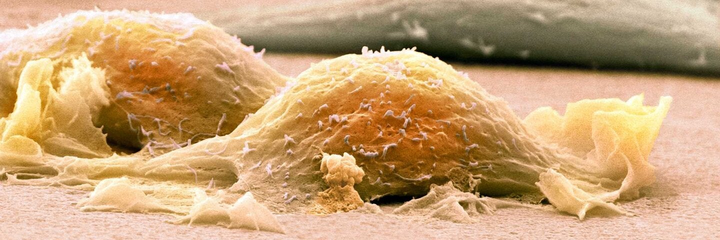 cancer-biology-mcd-biox405