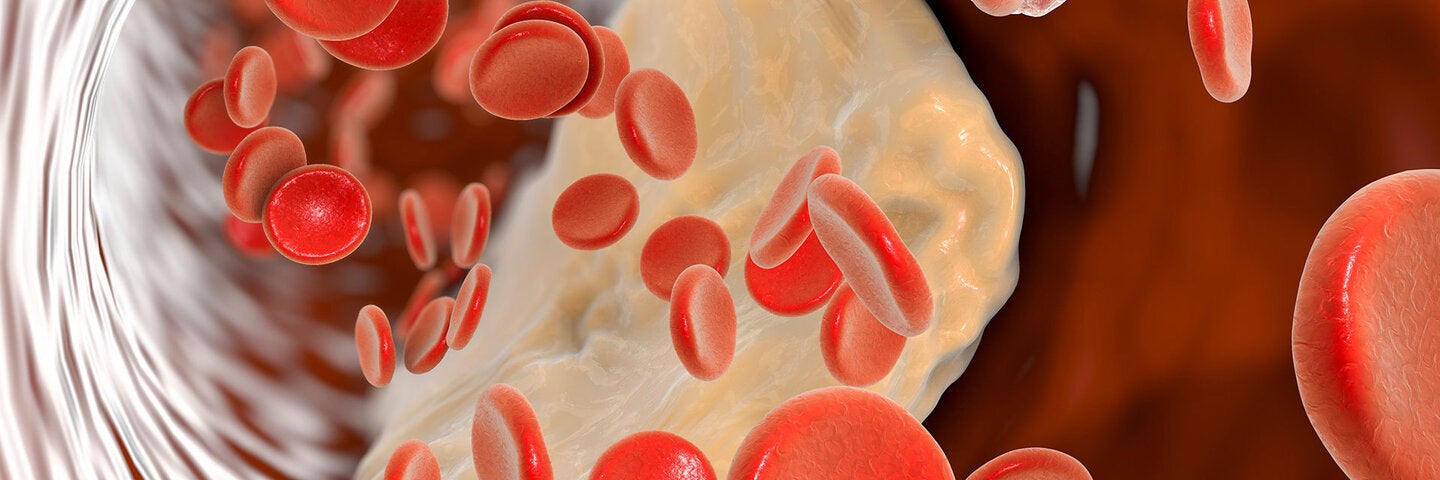 Inside a blood vessel during inflammation
