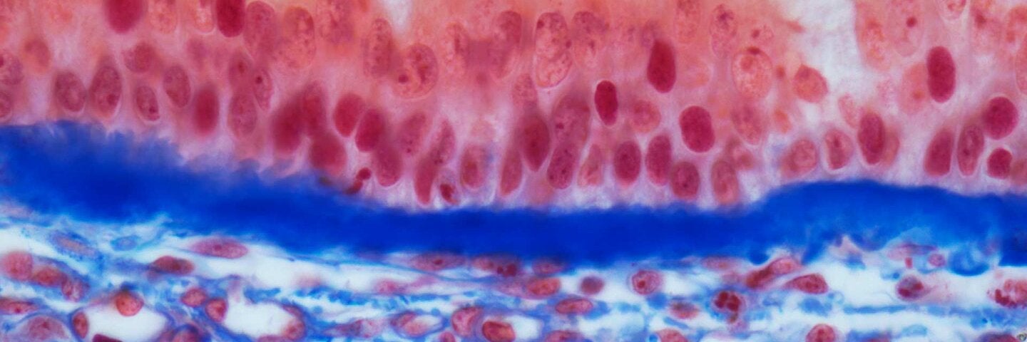 Trachea epithelium. Light micrograph 